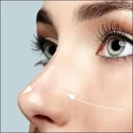 بهترین جراحی بینی در ایلام