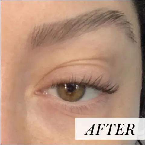 کاشت ابرو در قزوین