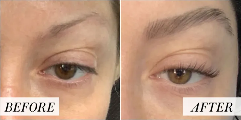 کاشت ابرو در قزوین ؛ زیبایی طبیعی و دائمی در دسترس شما