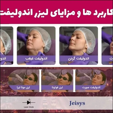 رفع لک صورت و جوانسازی با لیزر موهای زائد صورت امکان پذیر است؟