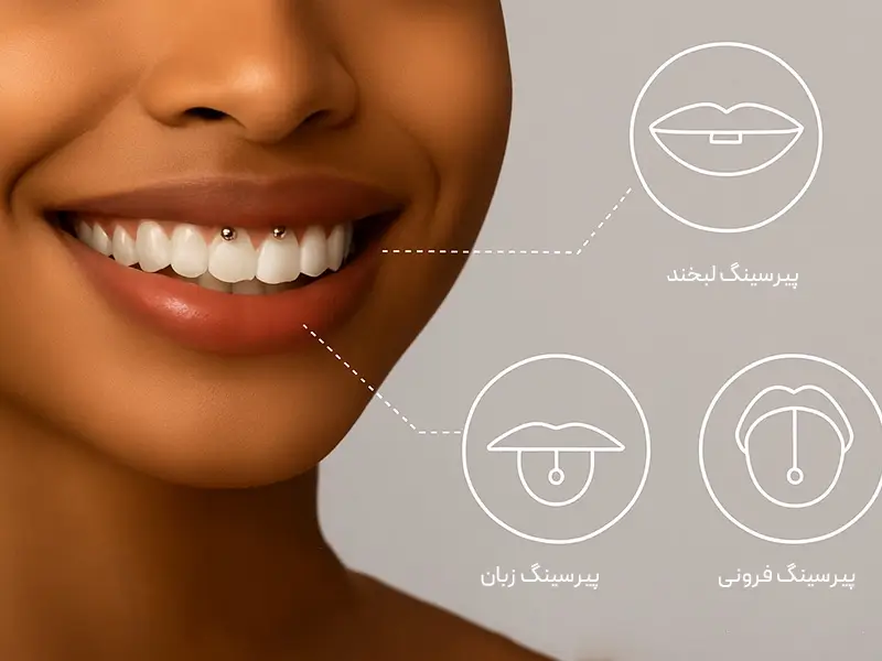 پیرسینگ‌ دهان